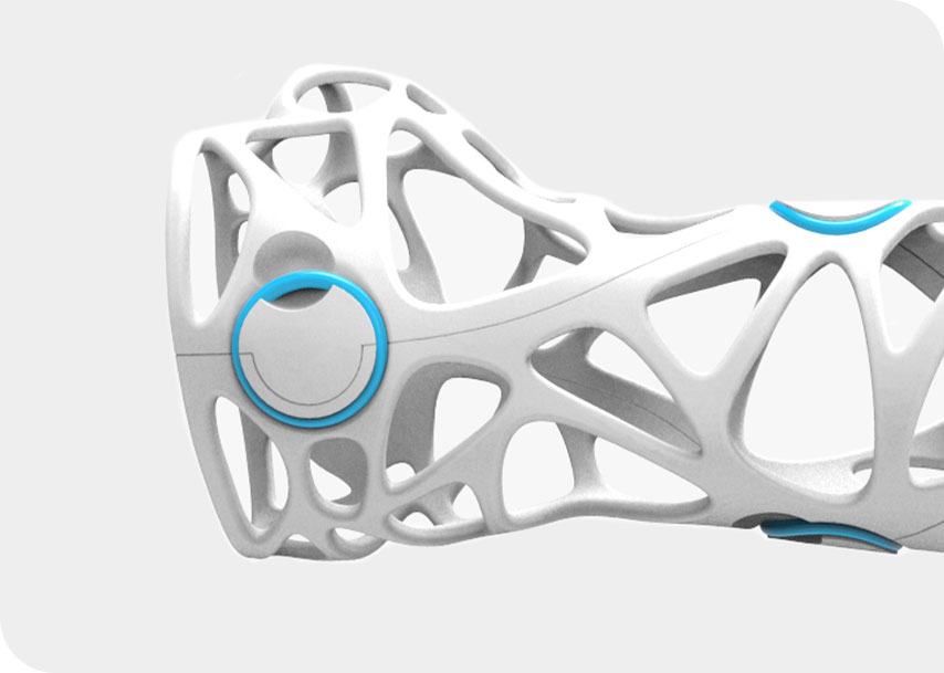 편안한 3D 개인 맞춤형 부목